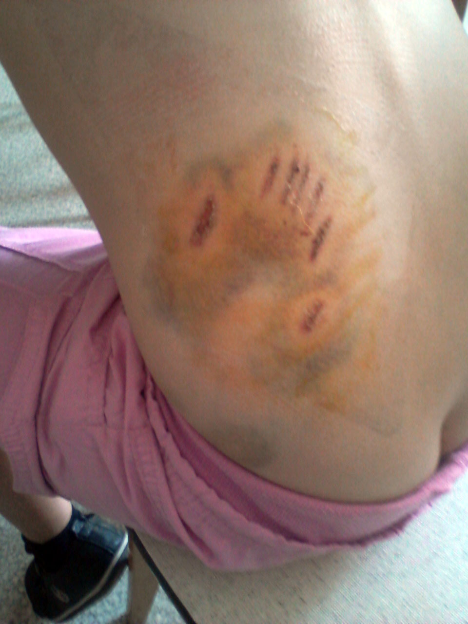 petition suite a morsure de berger allemand