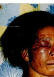 Eradiquer les violences conjugales