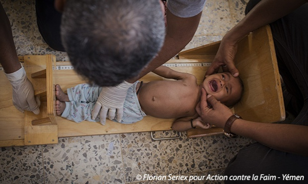 Le Yémen connaît aujourd’hui la pire crise humanitaire au monde, aidons les enfants à sortir du cercle infernal de la faim !