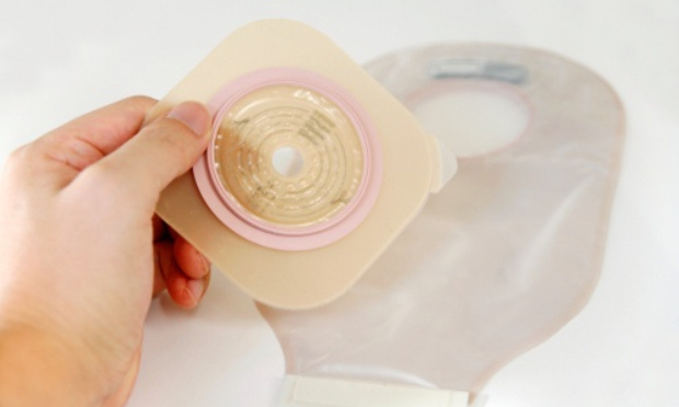 Pour un remboursement intégral de TOUTES les poches de stomies !