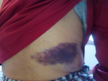 Justice pour un ancien combattant !