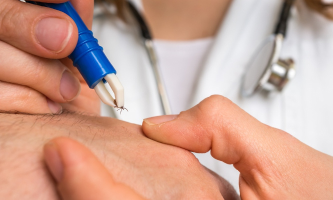 Recherches autour de la maladie de Lyme