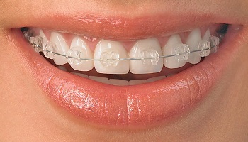 Pour une meilleure reconnaissance de la spécialité d'orthodontie