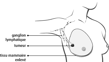 Les dénis de la justice