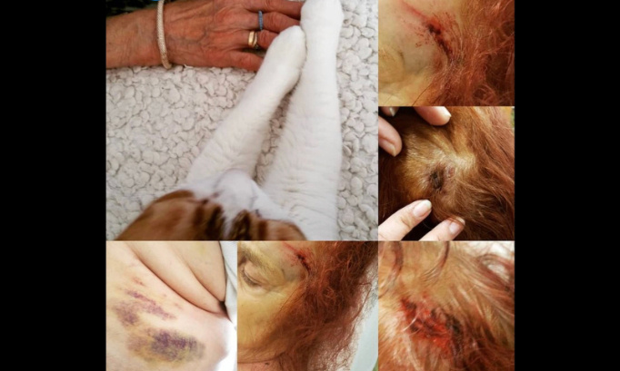 Stop à l'omerta de maltraitance de maman et nos aînés en ehpad !