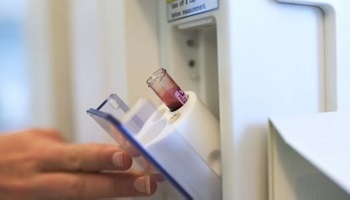 N'abandonnons pas le dépistage du cancer du poumon par simple prise de sang !