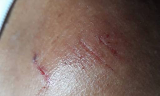 URGENT : POUR UN TRAITEMENT DIGNE DES PERSONNES EN MARTINIQUE