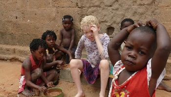 Stop à la maltraitance des enfants en Centrafrique !