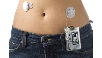 Les capteurs de glycémie coûtent trop cher