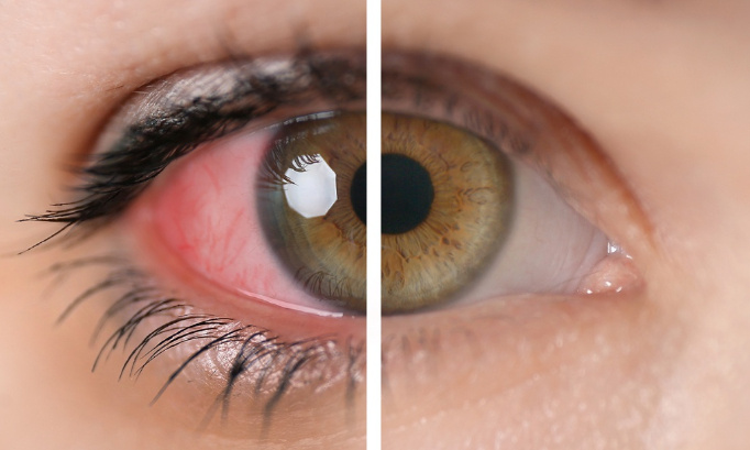 Mobilisez-vous pour réduire les délais d'obtention de rendez-vous chez l'ophtalmo