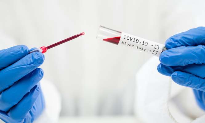 Pour systématiser un dépistage sérologique avant un vaccin de rappel