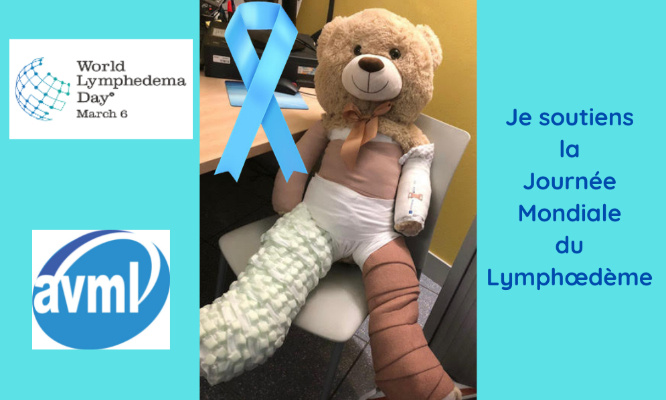 Pour une reconnaissance du lymphœdème : un combat quotidien !