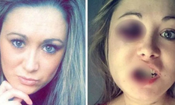 Plus de foyers pour femmes battues