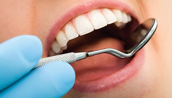 Nous exigeons que la tarification des soins dentaires soit encadrée et réglementée, mais également mieux remboursée