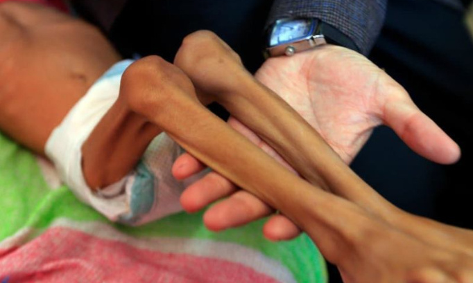 Pénurie de denrées alimentaires : Stop au gaspillage !