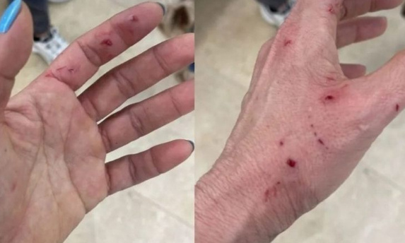 Trois gros chiens ont gravement attaqué un chiot et son propriétaire à Santiago de Surco