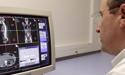 Le cancer et sa double peine