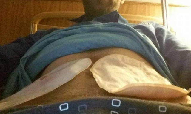 Aide pour finacement d'une voiturette  pour gagné liberté autonomie indépendance