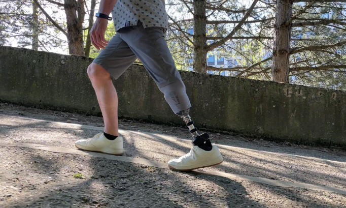 Rendre les prothèses de pieds articulées accessibles à tous / Maak voetprothesen met een gewricht toegankelijk voor iedereen