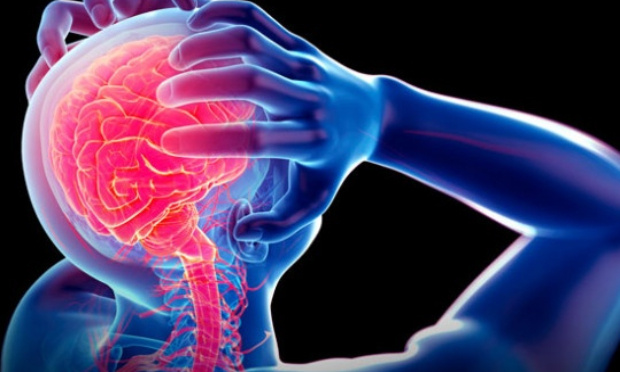 Pour la prise en charge des migraines hémiplégiques, maladie rare.