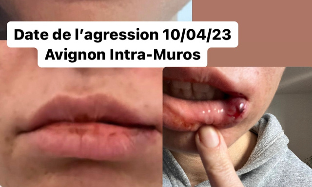 Pour en finir avec l’insécurité à Avignon Intra-Muros