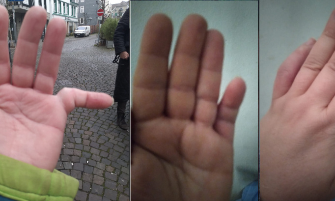 Justice pour Katja agressée et handicapée