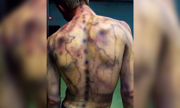 Pour enfin une vraie reconnaissance de la fibromyalgie