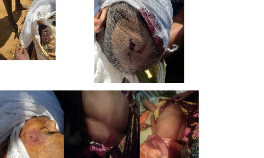 Soutenez les victimes d'abus de Droits Humains Fort-Dauphin Madagascar Octobre 2023