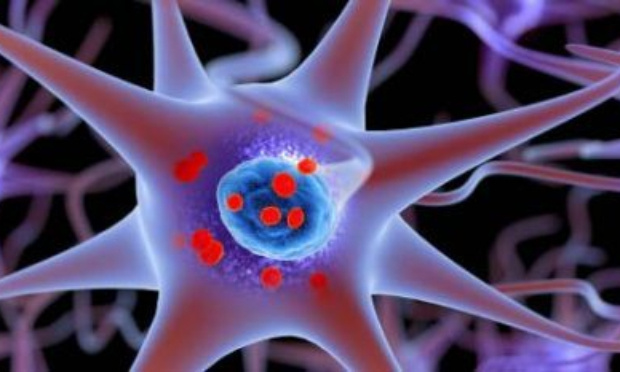 Exigeons le remboursement des médicaments contre la maladie à corps de Lewy !