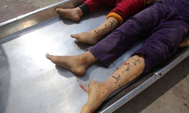 Petition : Les amputations des enfants massacrés de Gaza sont réalisées sans anesthésiant désormais !
