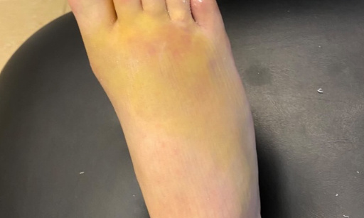 LOUISE ENVOIE CES PIEDS