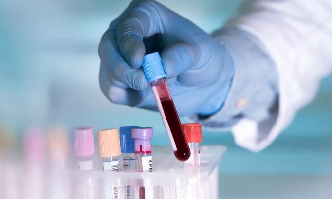 Justice et sécurité mettons fin à l'impunité !