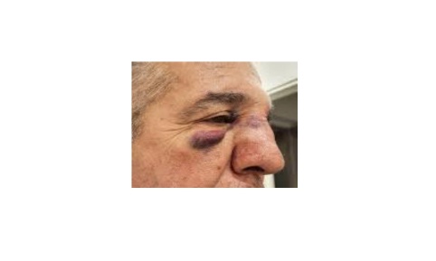 Soutien au médecin agressé à Drancy et indignation face à un verdict scandaleux