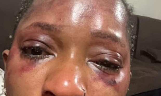 Annuler le concert de AZAYA (artiste Guinéen) reconnu pour maltraitance et violence sur sa femme