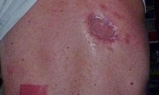 Depuis 12 ans en longue maladie (cancer), Claude 79 ans se retrouve sans médecin traitant