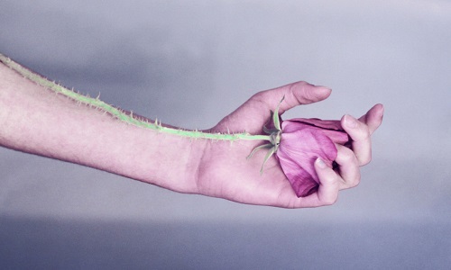 Pour la reconnaissance du SDRC comme pathologie neurologique !