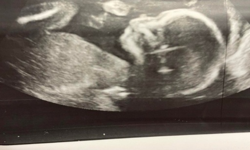 Stop au redéploiement du CHU UCL Namur et fermeture de Dinant