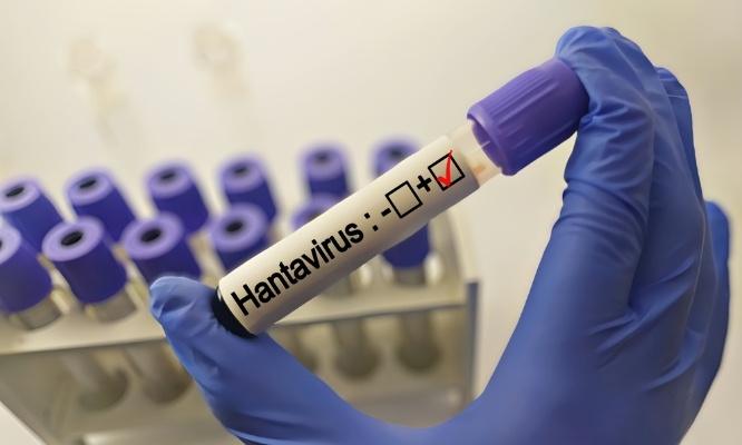 Stop &agrave; la psychose autour de l'Hantavirus !