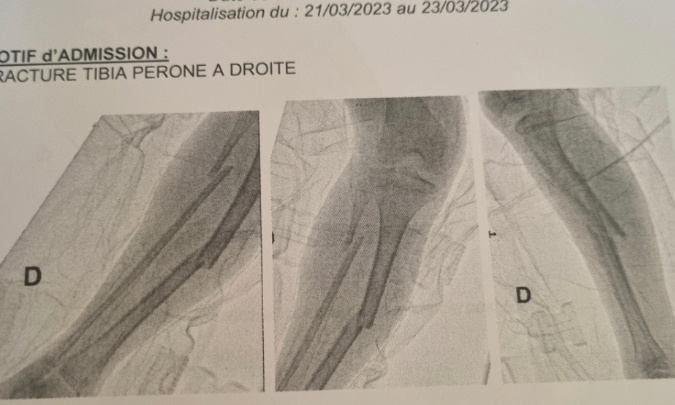 Agression violente en DITEP justice pour mon enfant de 11ans au moment des faits.