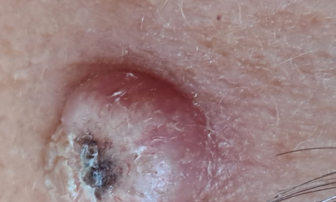 Pour un accès rapide aux dermatologues et pour préserver la mission santé publique des médecins spécialistes