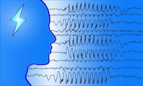 Légalité du CBD  pharmaceutique en France