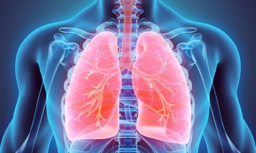 Pour un dépistage automatique du cancer du poumon après 50 ans