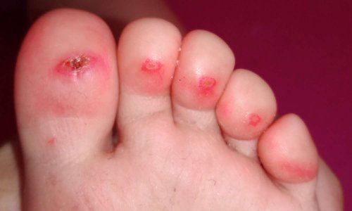 Faire changer le revêtement de la piscine  de l'Aqua Isis