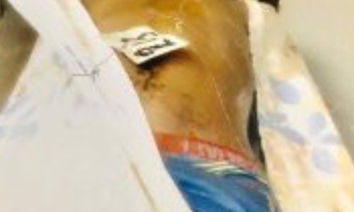 Vérité et Justice pour les Enfants de Chacona (congo)