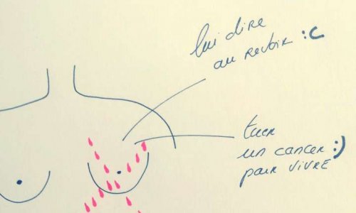 Cancer du sein : Pour une prise en charge totale des soins esthétiques et psychologiques