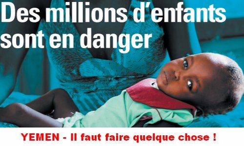 Aidez-nous à faire stopper la souffrance, la misère, la famine au Yemen