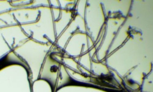 Contrôler les émissions de microfibres pour les laves-linge et les vêtements