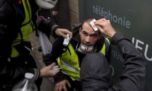 Pétition contre l'utilisation d'armes offensives interdites et mutilantes en France