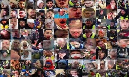 Pour que la cagnotte dédiée aux 2 CRS blessés par M. Dettinger soit partagée entre toutes les victimes déclarées des 2 bords GJ et Forces de l'ordre