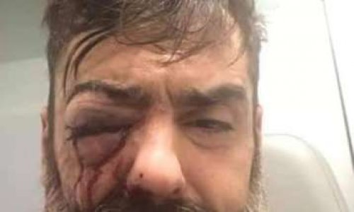 Démission de Mr Castaner au vu de sa politique de répression anti démocratique , soutenu par Mr Macron .